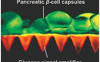 近两年糖尿病领域出现的那些“黑科技”们