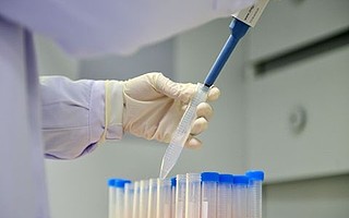 “好奇心市場”中長出的潛在“獨角獸”