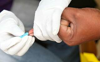 血液檢測法能以94％的準確率診斷阿爾茨海默氏癥