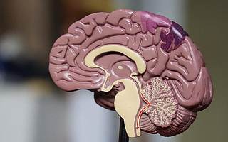 「科技醫療100+」強聯智創秦嵐：做腦血管病AI的“must to have”