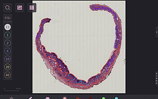 “透彻影像”获数千万元Pre-A轮融资 20秒内完成单张切片分析