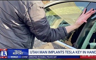 一名男子將特斯拉鑰匙芯片植入手中，實現 “無鑰匙開門”