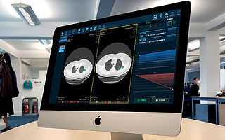 AI醫療影像輔助診斷系統研發商“醫準智能”完成近億元B輪融資
