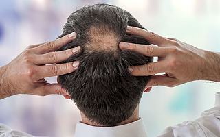 为了显得头顶富裕点，女孩们把假刘海买成了淘宝爆款