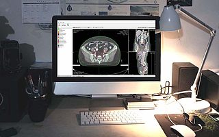 人工智能肿瘤治疗服务商“医智影科技”完成数千万元Pre-A轮融资