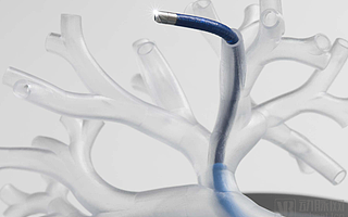 强生、直观外科正面PK，肺部介入机器人将成为新风口？