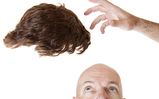 “禿然經濟”紅利凸顯，植發第一股應運而生