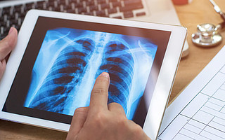 依图医疗“卖身”深睿，成中国医疗AI影像领域最大并购