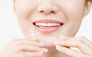 隐适美、时代天使占据80%以上市场，隐形正畸领域谁是下个巨头？